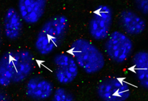 Retroviral Elements Could Be Exploited to Fight Esophageal Cancer