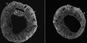 Self-Organizing, Beating Chambered Human Heart Cardioids Offer New Model for Research