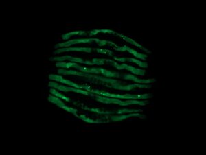 Specific Gut Bacteria Linked with Protein Aggregation Characteristic of Parkinson’s, Alzheimer’s Diseases