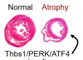 Cardiac atrophy findings may set course for preventing harm from long space flights