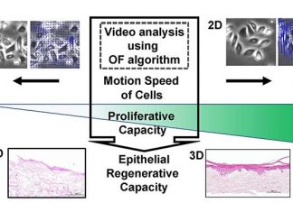 Cells/colony motion index of oral keratinocytes predicts epithelial regenerative capacity