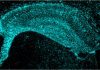 LDL Receptor Identified as Surprising Potential Therapeutic Target for Alzheimer’s Disease