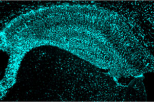 LDL Receptor Identified as Surprising Potential Therapeutic Target for Alzheimer’s Disease