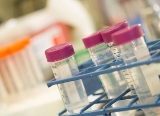 New study uncovers details behind the body’s response to stress