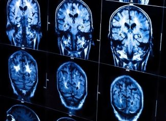 New X-ray scanner could revolutionize cancer surgery, pathology, drug inspection