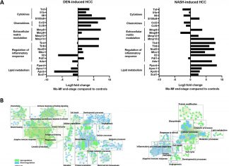 Oncotarget: Inflammatory microenvironment & hepatic macrophage in hepatocellular carcinoma