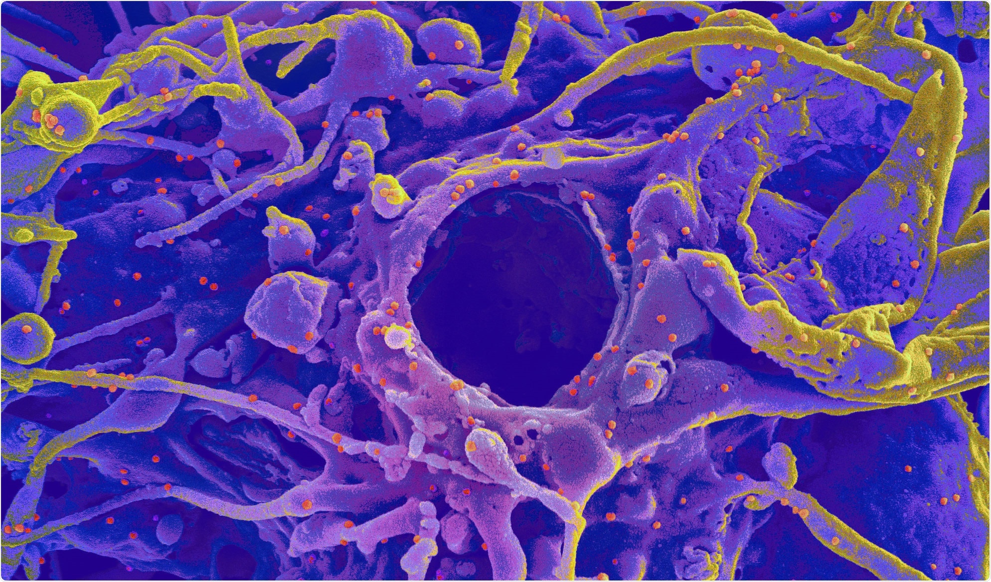 Alpha variant mutations help SARS-CoV-2 overcome evolutionary ...