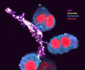 Boosting the Immune Pathway May Offer New Hope for Tuberculosis