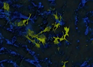 Cancer: Immunotherapies without side effects?