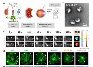 Exosome formulation developed to deliver antibodies for choroidal neovascularization therapy