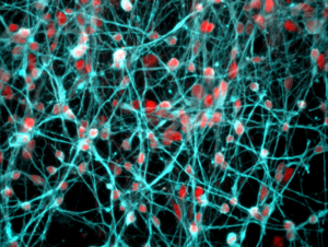 Stress Hormone Receptor-Hippocampal Gene Link Could Point to New Therapeutic Strategies for Mental Health Disorders