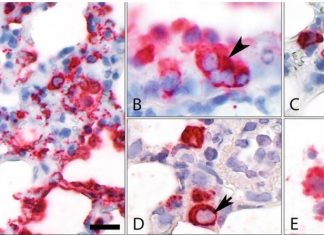 Syrian Hamster Unravels Inflammatory Insights in COVID-19