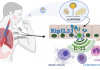 Allergies? Blame the Ripoptosome, an Allergen-Sensing “Platform”