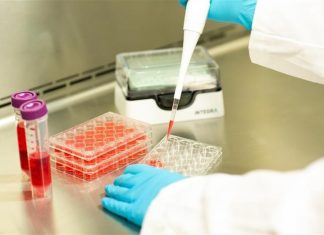 Careful pipetting reduces the stress on cells in culture