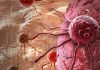 Combination of two drugs may help pancreatic and liver cancer patients