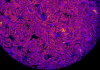 CRISPR-Engineered Cells Release Drug in Response to Inflammation When Implanted into Mice