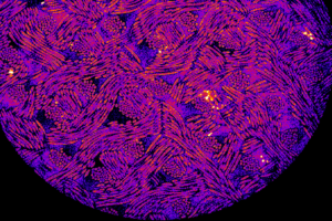 CRISPR-Engineered Cells Release Drug in Response to Inflammation When Implanted into Mice