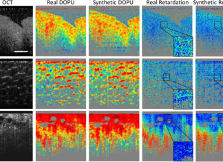 Deep learning enhances cancer diagnostic tools