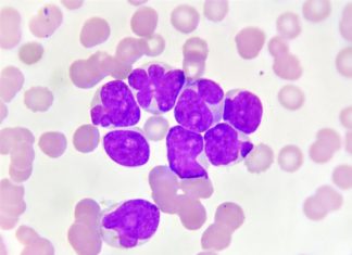 GammaDelta Therapeutics initiates first-in-human phase 1 trial of GDX012 for the treatment of acute myeloid leukemia