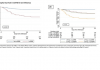 Shrinking waveforms on electrocardiograms predict worsening health and death of hospitalized COVID-19 and influenza patients
