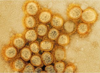 Scalp Eczema, Scalp Dermatitis, Scalp Psoriasis, or Dandruff: Which One Do You Have?