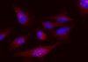 Zantrene® kills melanoma cancer cells that overproduce FTO