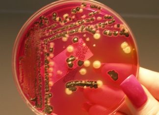 New defense mechanism makes lethal Salmonella strain resistant to viral infection