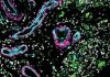 Atlas of Brain Vasculature Identifies New Cell Types and Links Immune Cells with Hemorrhagic Stroke