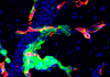 CNIO researchers design a drug screening platform compatible with patient biopsies to fight metastasis