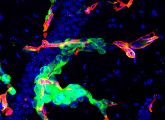 CNIO researchers design a drug screening platform compatible with patient biopsies to fight metastasis