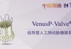 Venus Medtech appoints Shakeel Osman as Senior VP of Sales Europe to drive commercialization of TPVR system