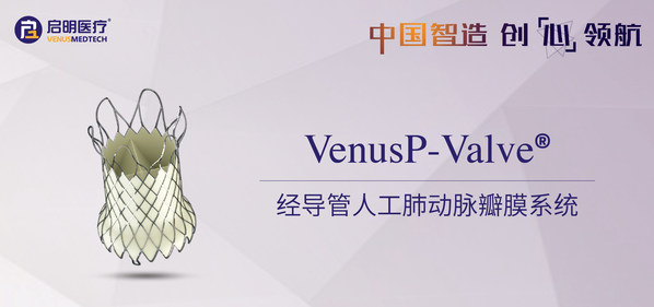 Venus Medtech appoints Shakeel Osman as Senior VP of Sales Europe to drive commercialization of TPVR system