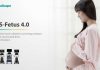 SonoScape S-Fetus 4.0 Release to Simplify Sonography Process