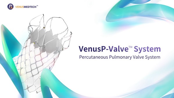VenusP-Valve(TM) obtains CE marking under MDR and debuts in Europe as China’s first valve product