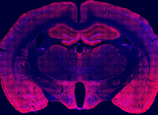 Scripps Research study reveals how alcohol cravings get stronger after drinking during withdrawal