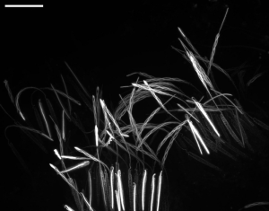 Jellyfish Sting Mechanism Unveiled; Could Help Design Future Delivery Devices