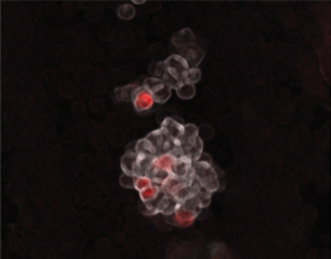 Study Overturns Understanding of How Blood Cells Form, With Implications for Leukemia Therapy