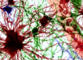 URMC Partners with Sana Biotechnology to Advance Cell-based Therapies in Neurological Disorders – URMC