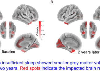 Children who lack sleep may experience detrimental impact on brain and cognitive development that persists over time