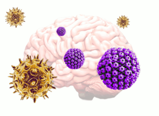 Common viruses may be triggering the onset of Alzheimer’s disease