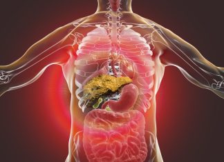 Rare Mutations in CIDEB Gene Protect against Liver Disease