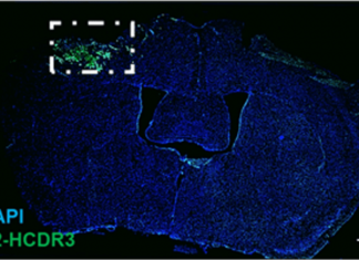 Scientists find molecular clues behind acute and chronic phases of traumatic brain injury