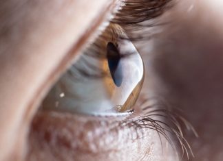 Bioengineered corneal tissue implantation restores vision in advanced keratoconus