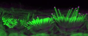 Gene Therapy Rescues Malfunctioning Inner Ear Hair Cells in Mice