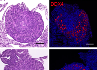 Study reveals how the ovarian reserve is established
