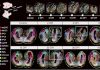 BGI-led Research Builds the World’s First Spatiotemporal Map of Brain Regeneration