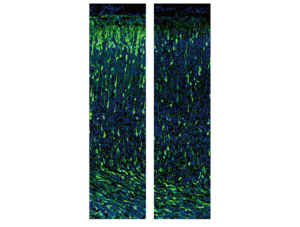 CHAMP1 Gene’s Role in Neuronal Development Described