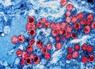 Evidence A.2 lineage of monkeypox is mutating