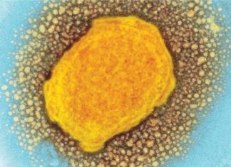 High-tech lab in Nigeria could be a game changer in tackling emerging and re-emerging diseases