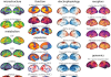 Brain Maps Together in One Place
